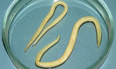 Roundworm from the human body