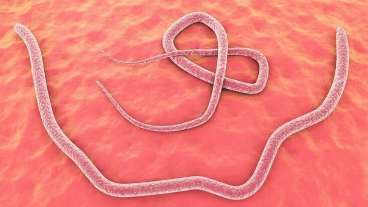 Roundworm in the human body