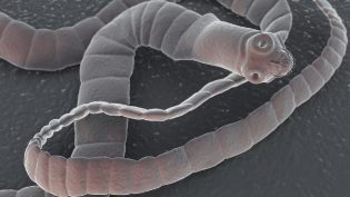 Signs of tapeworms