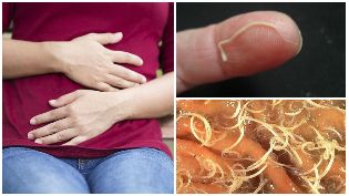 of worms in the human body